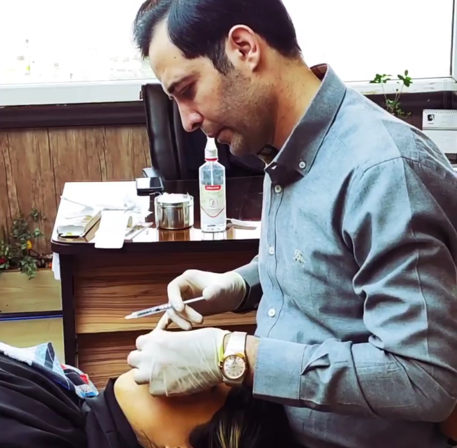 کاشت مو اقساطی توسط دکتر کامران دلیر در تهران
